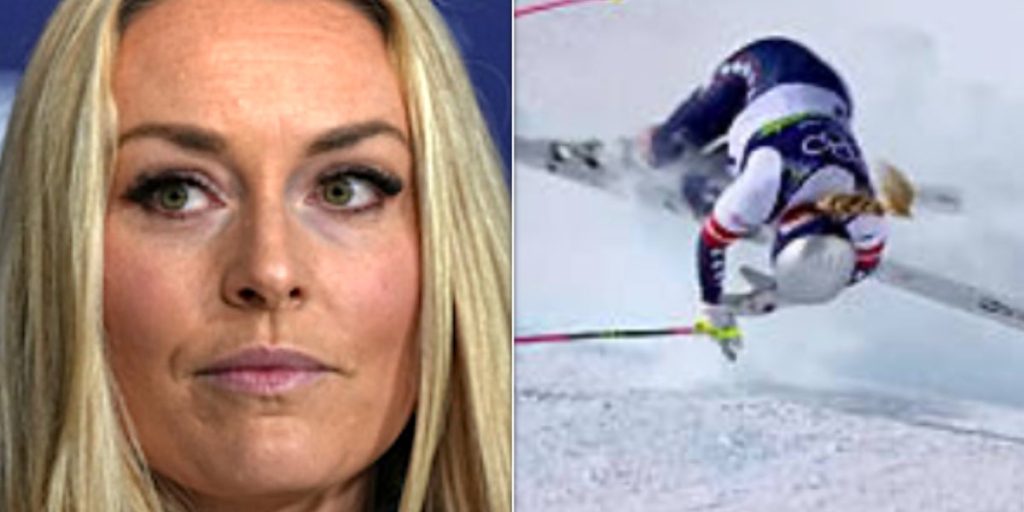Lindsey Vonn Shows Off Her X-Ray ... And Yikes 1 ab0325a6a52b47d9909b4ee2fc7cf3b2